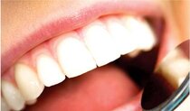 How do Natural tooth repair method with alzheimer's drugs revolutionize dental treatment?